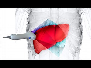 Introducing Velacur™: The First Handheld 3D Liver Health Assessment Tool