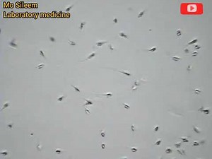 Live sperms under microscope (motility)