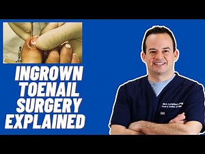 Ingrown toenail surgery explained | Dr. Nick Campitelli