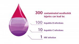 Vascular access in dialysis