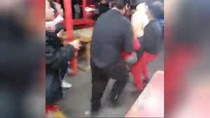 Man seriously injured in fireworks accident reacts to viral video of teen blowing hand off