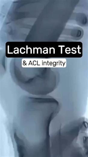 12K views · 34 reactions | The Lachman test evaluates the integrity of the ACL ‍♂️Explore effective strategies to assist your patients in returning to their activities in the field  Check out the various lecture on ACL rehab on Trust Me-Ed or purchase the ultimate ACL course by Lee Herrington & Sebastiano Nutarelli at @trust_mee_dude | Trust me, I'm a Physiotherapist | Facebook