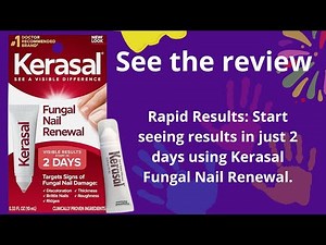 Kerasal Nail Renewal REVIEW – Does It REALLY Restore Discolored & Damaged Nails?