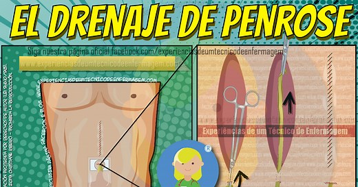 El Drenage de Penrose - Enfermagem Ilustrada