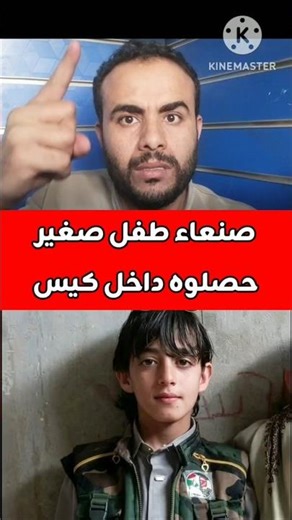 طفل يمني وجدوه داخل كيس في صنعاء #رادار_اليمن