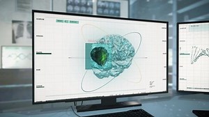 Medical Computer Diagnostic System Discovers Brain 库存影片视频（100% 免版税）1089651431 | Shutterstock