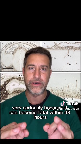 🧠 Blood-brain barrier forms at 6–8 weeks! Before 6–8 weeks: ❌ No barrier = anything in blood reaches brain ⚠️ Bacteria/virus can cause meningitis in 48 hours (FATAL!) 🏡 Keep baby away from people After 6–8 weeks: ✅ Barrier formed = brain protected 👫 Can be around people (use common sense!) 🚨 Any fever/symptoms in first 6–8 weeks = EMERGENCY Keep newborns indoors (walks OK, just not around people!) #BloodBrainBarrier #NewbornSafety #MeningitisPrevention #pregnancy