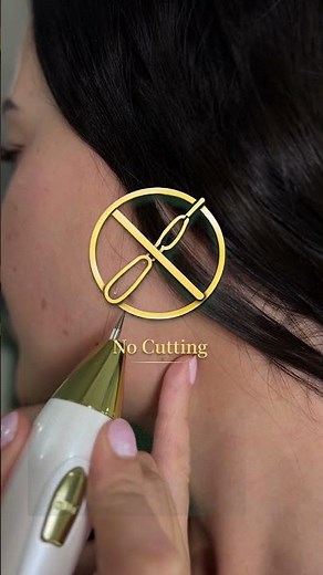 How I Remove Skin Tags On My Neck At Home (No Creams, No Cutting)