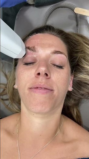 Doctor explains how to get a Non-Surgical Face Lift at Dr. Medispa