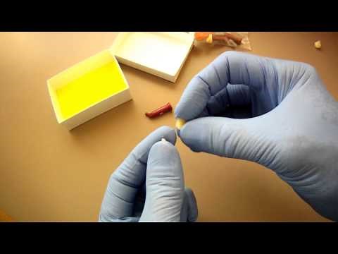 "Tooth-Bridge-It©" Do It Yourself Kit #1...