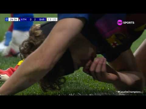 Fermín López TERRIBLE INJURY | Atletico Madrid vs Barcelona | UEFA Champions League 2025/26