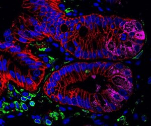 The Microbiome is Affected by the Genome of Its Host | Microbiology
