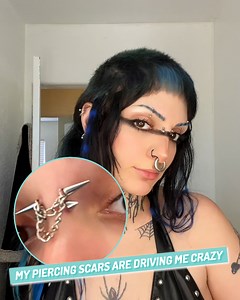 Professionals warned me not to try this method, but I need my piercing scars gone 😰 | Ultimate