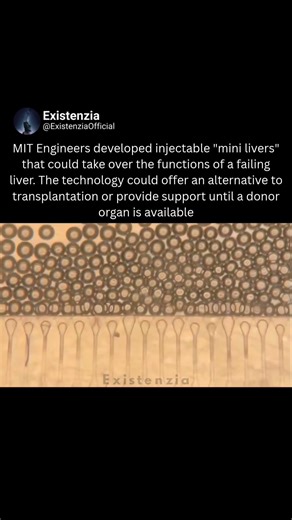 Injectable Mini Livers That Could Revolutionize Liver Failure Treatment