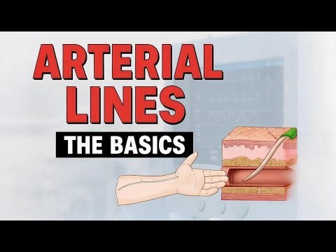 ARTERIAL LINES: The Critical Care Skill That Could Save Your Patient's Life (Complete Guide)