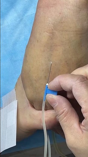 How to Give IV Injection Safely |Doctor uncle Sui injection |IV & Intramuscular IM #shorts #ytshorts