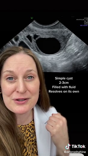 Understanding Ovarian Cysts vs. PCOS: A Detailed Comparison