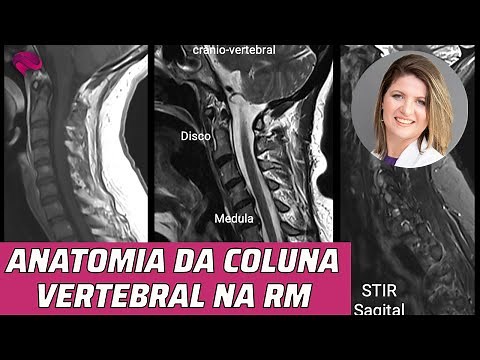 ANATOMIA DA COLUNA VERTEBRAL NA RESSONÂNCIA MAGNÉTICA