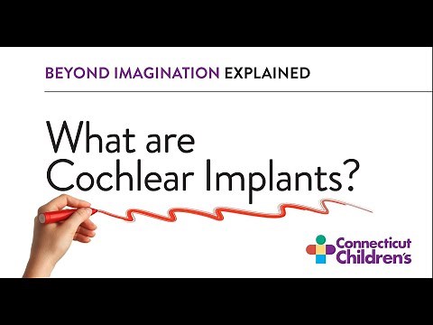 What Are Cochlear Implants? | Connecticut Children's