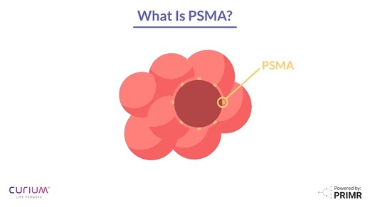 13 reactions |  What is PSMA? Prostate-Specific Membrane Antigen (PSMA) is a protein that functions like a beacon and is highly expressed on most prostate cancer cells. It enables doctors to accurately locate and target cancer for both #imaging and #treatment. Watch the full video to learn about #PSMA and view our full resource on radiopharmaceuticals at zerocancer.org/radiopharmaceuticals. #ZEROProstateCancer #Radiopharmaceuticals | ZERO Prostate Cancer | Facebook