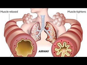 Bronchitis animation video. - YouTube