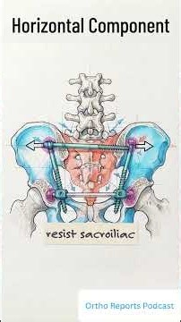 Minimally Invasive Fixation for a Metastatic Sacral Fracture | Ortho Reports Podcast