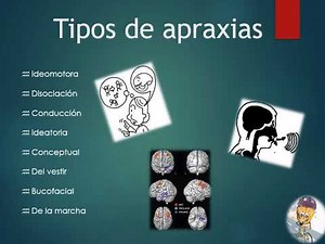 Apraxias