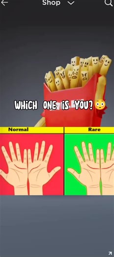 Normal vs Rare Hands: Which One Are You?