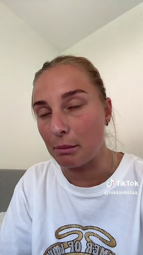 Alles over eczeem en allergieën: Tips en hulp