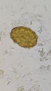 Stool sample 😲❤️🔬. #stoolsample #parasitology #medicallaboratoryscience #LabTechnician Lab life | Lab life