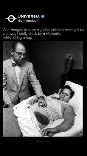 ​The Only Person Ever Hit by a Meteorite! ☄️🏠