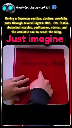 During C section, doctor carefully pass through several layers