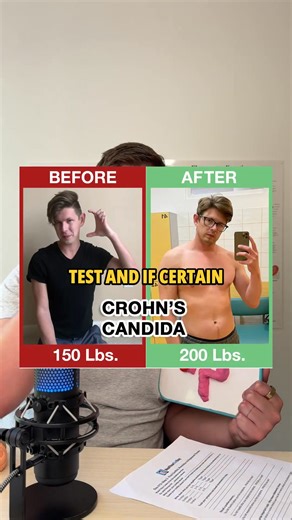 Leaky Gut, SIBO & Candida - How to Diagnose & The Cause and Cure! | Heal Your Gut Guy