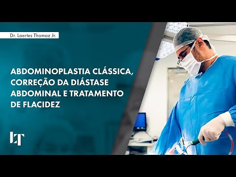 ABDOMINOPLASTIA CLÁSSICA, CORREÇÃO DA DIÁSTASE ABDOMINAL E TRATAMENTO DE FLACIDEZ | DR LAERTES