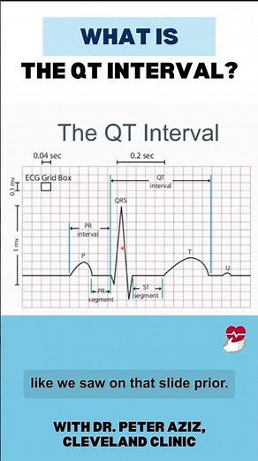 What is the QT interval?