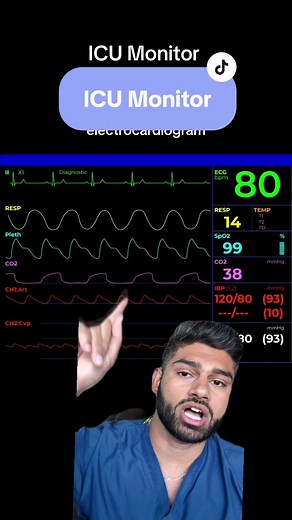 A typical ICU monitor and the vital signs that it shows #icu #criticalcare #doctor #nurse