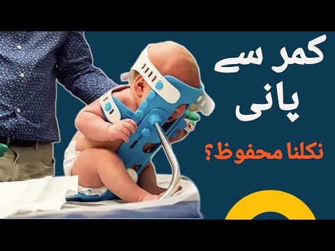 Lumbar Puncture in Babies | Safe or Risky? Parents Must Know! | Dr. Hina Baig