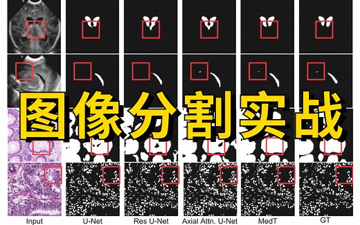 比刷剧还爽！图像分割经典项目实战系列，手把手教你做unet医学细胞分割实战，看不懂你打我！！—人工智能/图像分割/深度学习/AI