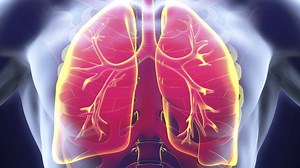 Qu'est-ce qu'une infection pulmonaire ?