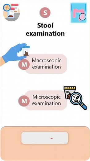 Giardia lamblia-stool examination #parasitology #microbiology #pathology #neet #neetpg #biology