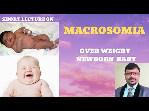 WHAT IS MACROSOMIA- CAUSES OF OVER WEIGHT NEWBORN BABY- FETAL MACROSOMIA