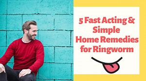 5 Fast Acting & Simple Home Remedies for Ringworm