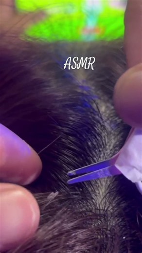 ASMR Scalp Check & Dandruff Removal #asmr