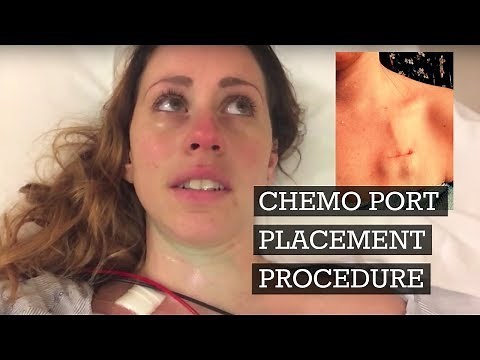 CHEMO PORT PLACEMENT PROCEDURE {VLOG}