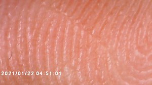Watch Look at my fingerprints under the microscope on Amazon Live