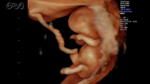 おなかの赤ちゃんを見てみよう① | NHK for School