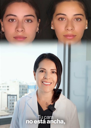 Solución al Bruxismo: Reduce el Tamaño del Masetero