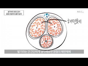 [Erectile Dysfunction Cause Test 2. Penile Doppler Test] Erectile Dysfunction Test is a test to i...
