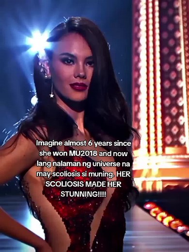 Catriona Gray: Embracing Scoliosis for Beauty and Strength