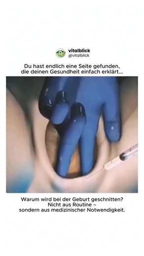 Vitalblick on Instagram: "Das hier ist kein Zufall – sondern ein gezielter Eingriff ⚕️ 🩺 Was du siehst: Eine Episiotomie (Dammschnitt) 🔬 Was dabei passiert: Bei der Geburt wird der Damm (das Gewebe zwischen Scheide und After) kontrolliert eingeschnitten, um den Geburtskanal zu erweitern. 👶 Warum das gemacht wird: • Wenn das Baby schnell geboren werden muss • Bei starkem Geburtsstress • Um unkontrollierte, tiefe Risse zu vermeiden • Bei instrumenteller Geburt (Saugglocke/Zange) 📍 Formen des S